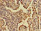 Alpha-2-Macroglobulin Like 1 antibody, LS-C682147, Lifespan Biosciences, Immunohistochemistry paraffin image 