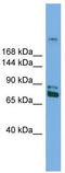 DNA Methyltransferase 1 antibody, TA342255, Origene, Western Blot image 