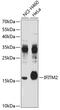 Interferon Induced Transmembrane Protein 2 antibody, 19-369, ProSci, Western Blot image 