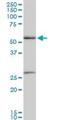 Pre-mRNA-processing factor 19 antibody, H00027339-M07, Novus Biologicals, Western Blot image 
