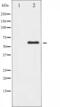 X-Linked Inhibitor Of Apoptosis antibody, abx011750, Abbexa, Western Blot image 