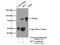 Methylmalonyl-CoA Mutase antibody, 17034-1-AP, Proteintech Group, Immunoprecipitation image 