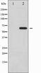 PXN antibody, TA327810, Origene, Western Blot image 