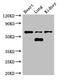 Ceramide Kinase antibody, CSB-PA005256LA01HU, Cusabio, Western Blot image 