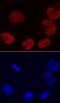Protein DEK antibody, MAB70201, R&D Systems, Immunofluorescence image 