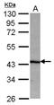 Ribosomal Oxygenase 1 antibody, NBP2-15042, Novus Biologicals, Western Blot image 