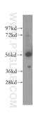 3-Oxoacid CoA-Transferase 1 antibody, 12175-1-AP, Proteintech Group, Western Blot image 