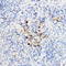 Chitinase 3 Like 1 antibody, GTX55570, GeneTex, Immunohistochemistry paraffin image 
