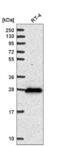 Dehydrogenase/reductase SDR family member 2 antibody, NBP2-56196, Novus Biologicals, Western Blot image 