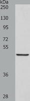 AlkB Homolog 1, Histone H2A Dioxygenase antibody, TA321740, Origene, Western Blot image 