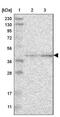 Calcium Activated Nucleotidase 1 antibody, NBP1-87081, Novus Biologicals, Western Blot image 