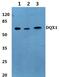 DEAQ-Box RNA Dependent ATPase 1 antibody, PA5-36432, Invitrogen Antibodies, Western Blot image 