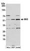 MAP kinase-activated protein kinase 5 antibody, A302-612A, Bethyl Labs, Western Blot image 