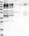 Ring Finger Protein 216 antibody, NBP1-86906, Novus Biologicals, Western Blot image 