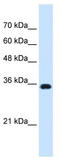 ATPase Na+/K+ Transporting Subunit Beta 1 antibody, TA335284, Origene, Western Blot image 