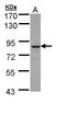 Bardet-Biedl Syndrome 7 antibody, LS-B14804, Lifespan Biosciences, Western Blot image 