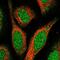 Spermatogenesis Associated 24 antibody, PA5-60578, Invitrogen Antibodies, Immunofluorescence image 