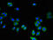Leupaxin antibody, A62890-100, Epigentek, Immunofluorescence image 