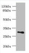 Transmembrane Protein 176B antibody, A61382-100, Epigentek, Western Blot image 