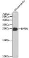Epididymal Peptidase Inhibitor antibody, 18-534, ProSci, Western Blot image 
