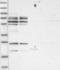 SSX Family Member 2 Interacting Protein antibody, NBP1-85956, Novus Biologicals, Western Blot image 