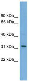 Cytokine receptor-like factor 2 antibody, TA336112, Origene, Western Blot image 