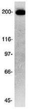 Cytoskeleton-associated protein 5 antibody, PA3-16835, Invitrogen Antibodies, Western Blot image 