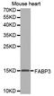 Fatty Acid Binding Protein 3 antibody, STJ23604, St John