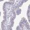 Dynein Axonemal Heavy Chain 14 antibody, NBP2-38182, Novus Biologicals, Immunohistochemistry frozen image 