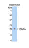 Alpha-2-Macroglobulin antibody, LS-C292751, Lifespan Biosciences, Western Blot image 