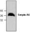 Serpin Family A Member 6 antibody, GTX59871, GeneTex, Western Blot image 