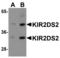 Killer cell immunoglobulin-like receptor 2DS2 antibody, LS-C358485, Lifespan Biosciences, Western Blot image 