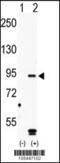 MAP/microtubule affinity-regulating kinase 4 antibody, 62-685, ProSci, Western Blot image 