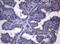 Nuclear Receptor Subfamily 1 Group H Member 4 antibody, LS-C798674, Lifespan Biosciences, Immunohistochemistry paraffin image 