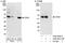 Cyclin Dependent Kinase 8 antibody, A302-501A, Bethyl Labs, Western Blot image 