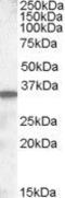 Solute Carrier Family 10 Member 2 antibody, GTX88608, GeneTex, Western Blot image 