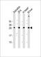 Adenylate kinase 2, mitochondrial antibody, M04253, Boster Biological Technology, Western Blot image 