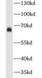 Carbonic Anhydrase 9 antibody, FNab01153, FineTest, Western Blot image 