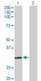 Arylamine N-acetyltransferase 2 antibody, H00000010-M01, Novus Biologicals, Western Blot image 