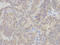 Charged Multivesicular Body Protein 2B antibody, A01935, Boster Biological Technology, Immunohistochemistry paraffin image 
