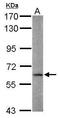 Fatty Acid Amide Hydrolase antibody, GTX124189, GeneTex, Western Blot image 