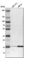 Acid Phosphatase antibody, HPA016754, Atlas Antibodies, Western Blot image 