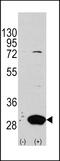 Latexin antibody, LS-B3422, Lifespan Biosciences, Western Blot image 