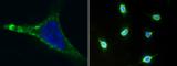 Cell surface glycoprotein MUC18 antibody, 10115-R044, Sino Biological, Immunofluorescence image 