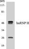 Heterogeneous Nuclear Ribonucleoprotein H2 antibody, EKC1754, Boster Biological Technology, Western Blot image 
