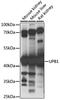 Beta-Ureidopropionase 1 antibody, LS-C750421, Lifespan Biosciences, Western Blot image 
