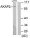 A-Kinase Anchoring Protein 2 antibody, TA315161, Origene, Western Blot image 
