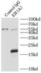 Eukaryotic Translation Initiation Factor 5A2 antibody, FNab02729, FineTest, Immunoprecipitation image 