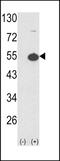 cAMP-dependent protein kinase type I-alpha regulatory subunit antibody, LS-C101197, Lifespan Biosciences, Western Blot image 