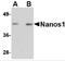 Nanos C2HC-Type Zinc Finger 1 antibody, 4685, ProSci Inc, Western Blot image 